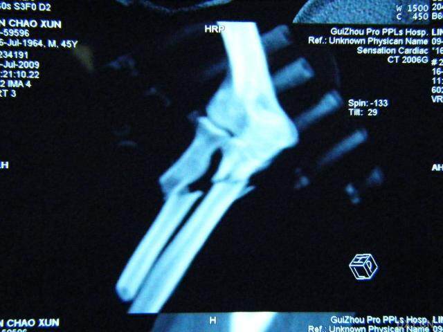 可雕刻板材 第9頁